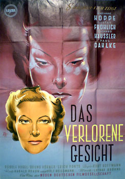 verlorene Gesicht, Das